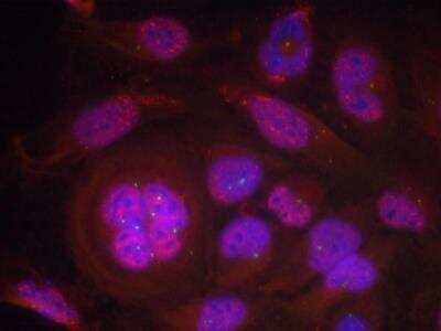 Immunocytochemistry/ Immunofluorescence: RelA/NFkB p65 [p Ser276] Antibody [NB100-82086]